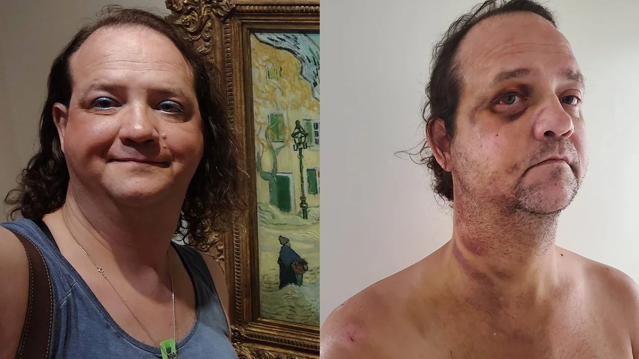 Transgender Woman Escapes Alabama for Safety, Brutally Attacked Near National Mall in D.C.